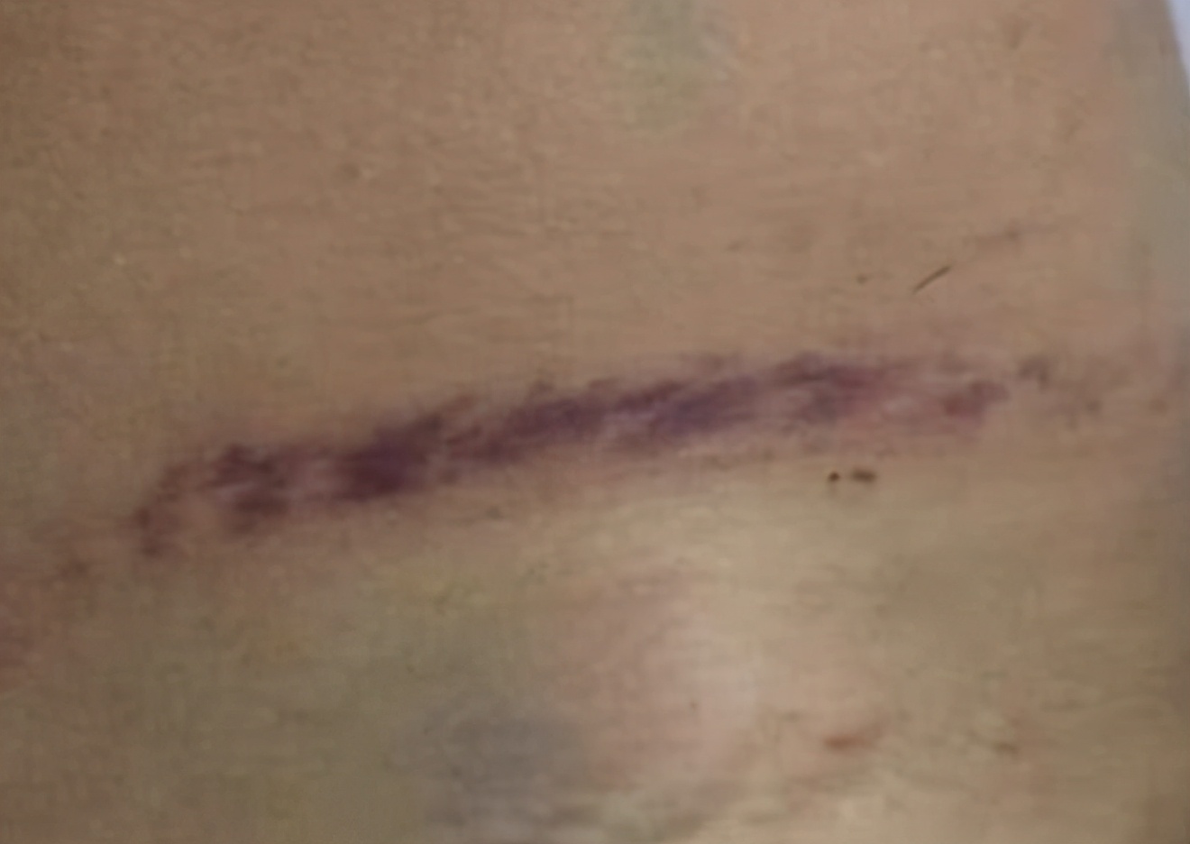 五千印记,三五印记