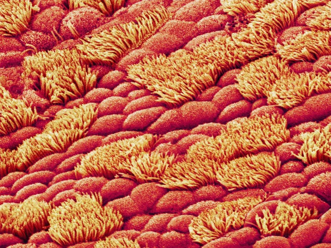 五颜六色鼻涕是什么原因,6类鼻涕暗示这些健康问题