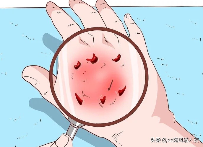 狗咬狗狗的伤口怎么处理,狗被狗咬的伤口肿了怎么办