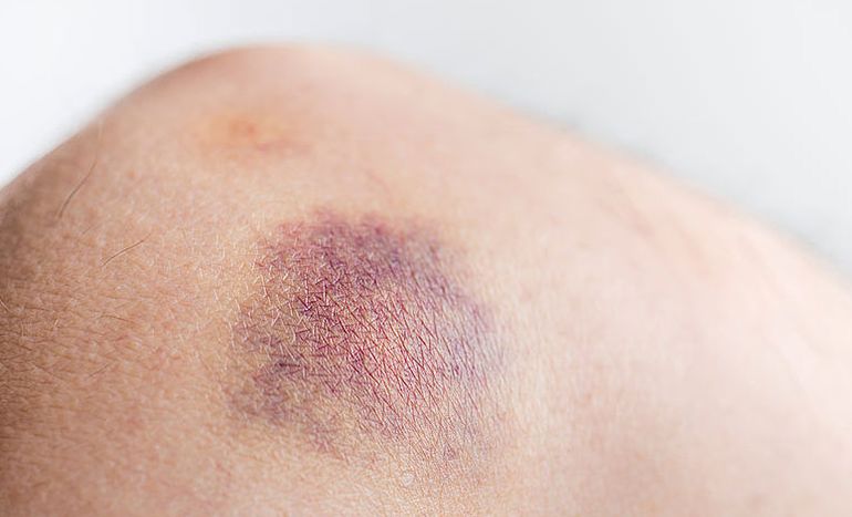 薄荷的解表功效,与薄荷有关的功效