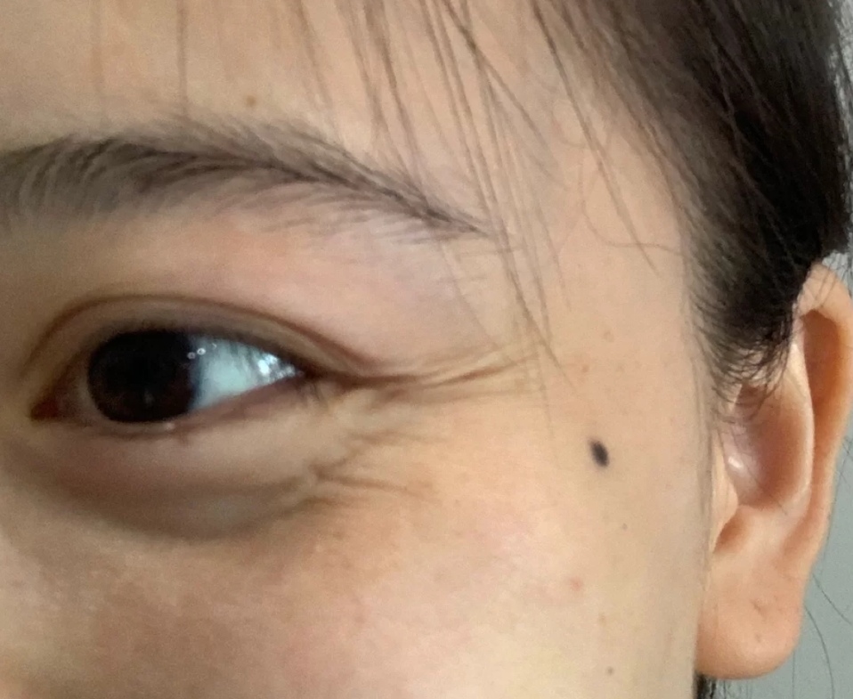 油性皮肤更抗衰老吗,油性皮肤保湿有用吗