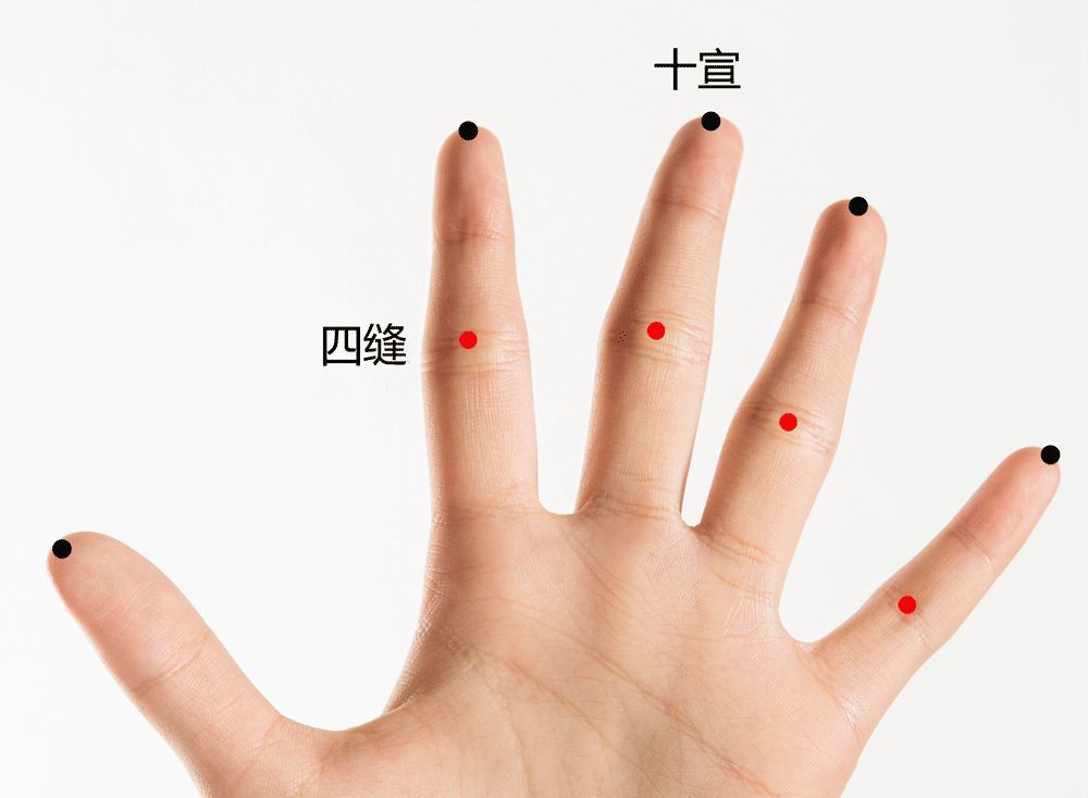 肠胃不好喝凉水都拉肚子怎么办,聚餐拉肚子怎么治