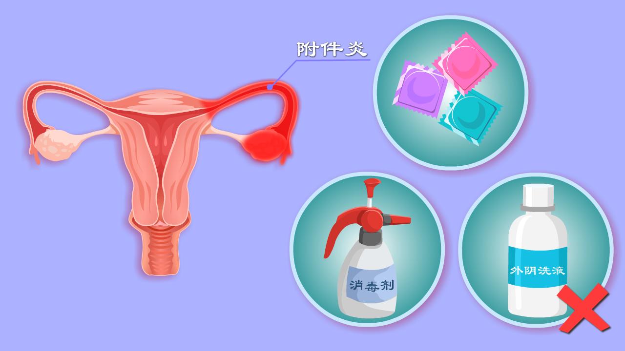 附件炎怎么造成的,人流后附件炎