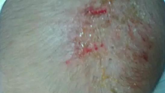 素东方科普|宝宝头上有头垢如何护理?