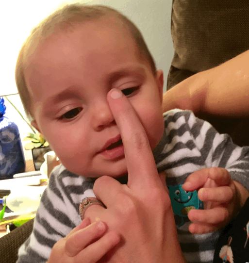 宝宝眼睛红是红眼病吗,新生宝宝眼睛红