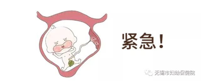 宫颈环扎感染早产,预防早产可以宫颈环扎术吗