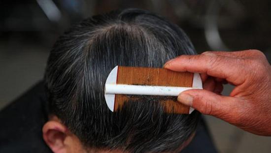 以前农村生活有虱子,为什么以前人长虱子现在没有虱子