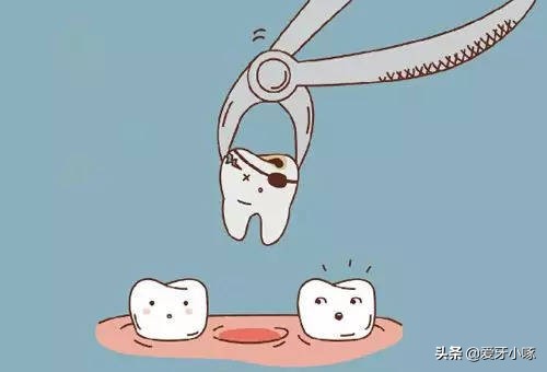 中年人牙齿松动拔了好还是脱落好,牙齿松动就拔好还是很松拔牙好