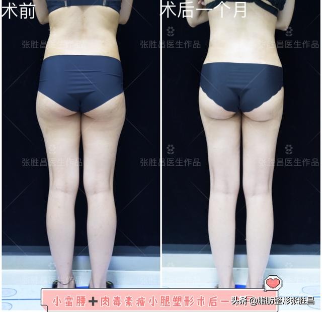 快速有效暴瘦腰腹练出马甲线,紧致身材零赘肉这样健身才最有效