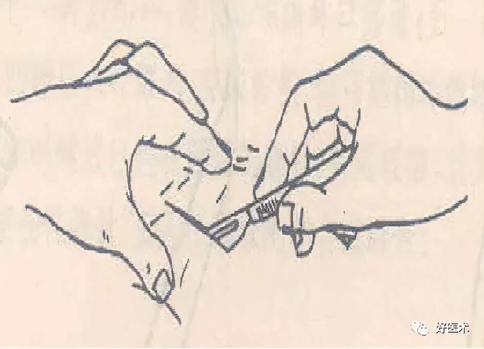 气管切开注意事项,切开引流注意事项