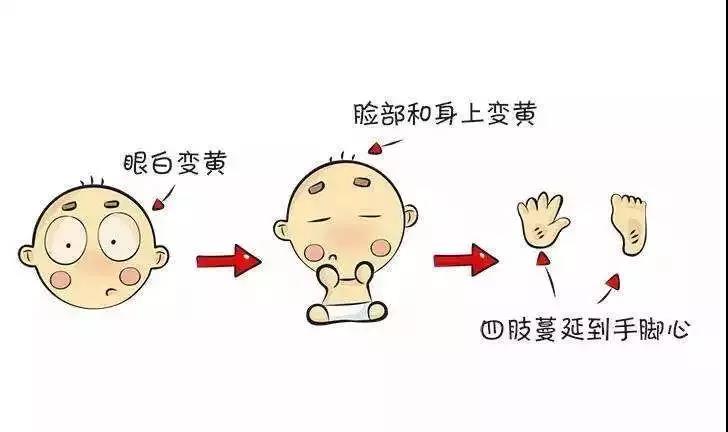 新生儿黄疸宝妈担心视频,新生儿黄疸护理和处理月嫂怎么做