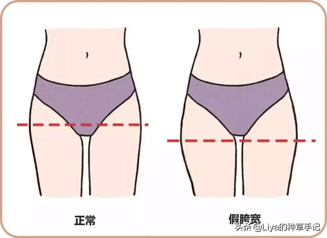 胯宽屁股大真的可以改善吗,屁股大胯宽有什么好