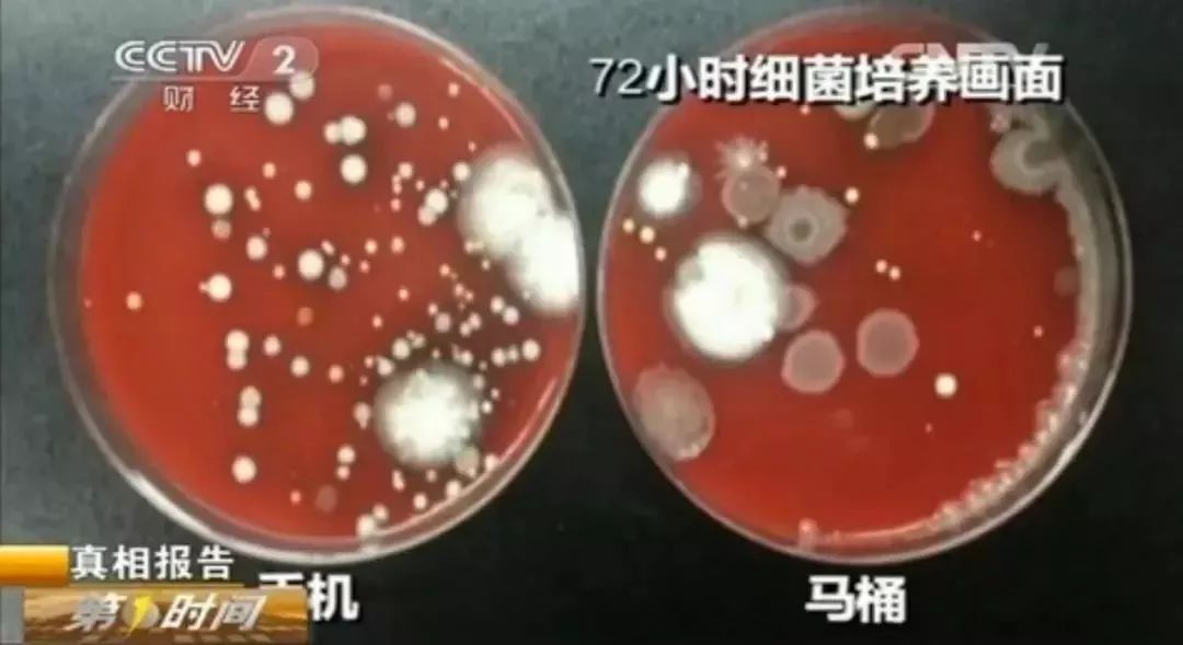 经常清洁可以消除大量的细菌,细菌和脏东西特别不容易清洗