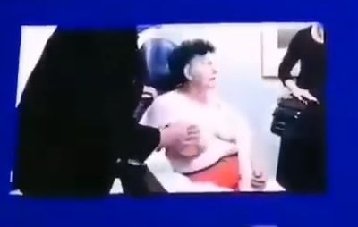 假体隆胸能保持多少年乳房不下垂,隆胸还是毁胸揭秘假体隆胸的危害