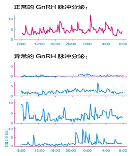 初中就开始长胡子了正常吗,为什么初中就开始长胡子