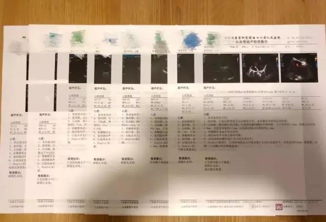 小孩被误诊为川崎病会怎样,小孩患川崎病的真实情况