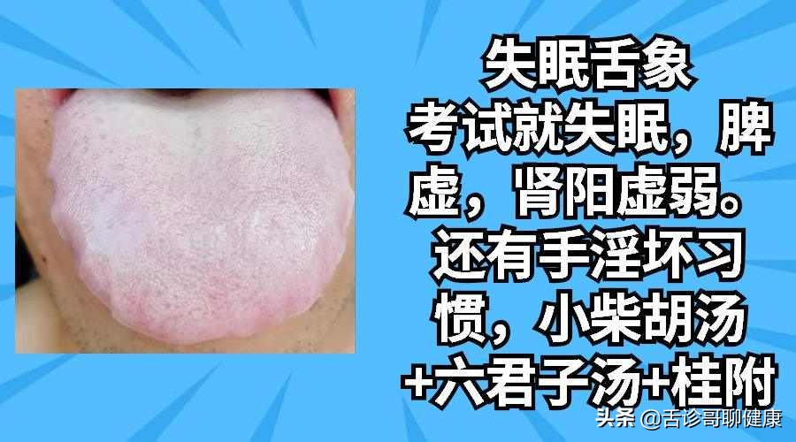舌诊歌舌象分析和感悟,舌诊歌舌象分析及感悟