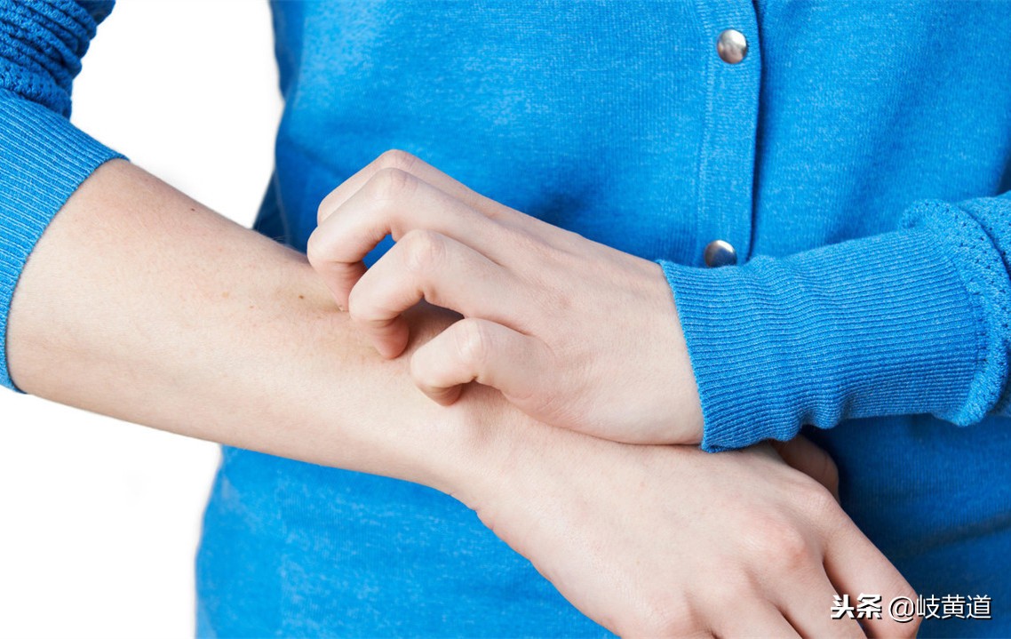 皮肤起红疙瘩荨麻疹怎样治疗,为什么皮肤发红疹荨麻疹不能治好