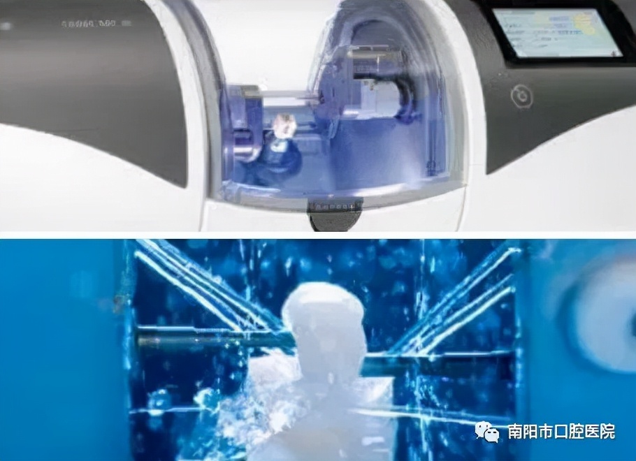 牙齿大面积龋坏牙冠都没了还疼,龋病牙体缺损的手术治疗