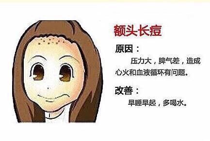 额头下巴长痘痘的原因是姨妈痘吗,额头下巴长痘痘的原因