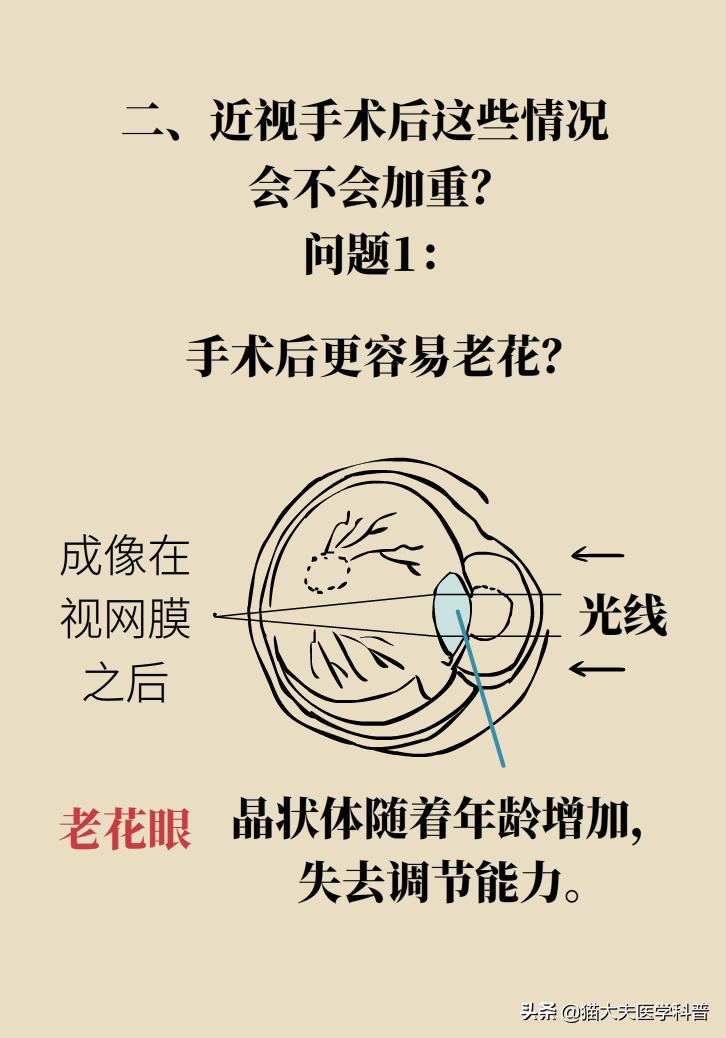 近视手术后视力1.0正常吗,近视手术后视力恢复1.0至1.5