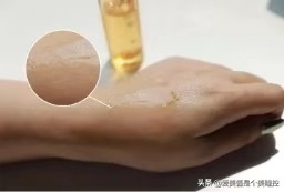 换季泛红用什么精华,换季护肤的小心得让你少走弯路