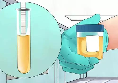 产前诊断是查些什么,产前检查最好从什么时候开始