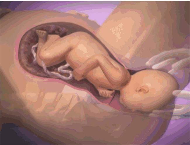 顺产痛不欲生就想从鬼门关走一趟,女人分娩如同鬼门关