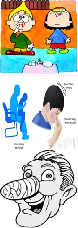 青少年常见运动伤害的处理方式,儿童常见运动损伤的正确处理