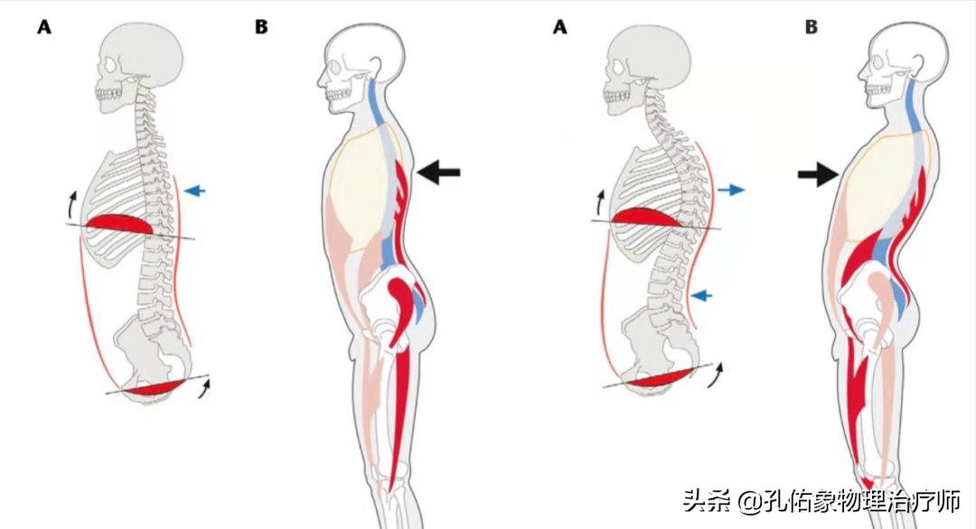 健康科普学这几招缓解产后腰痛,孕晚期突然腰痛厉害是产前征兆吗