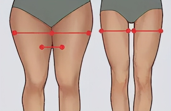 小腿粗下垂,怎么改变腿型小腿肌肉外翻