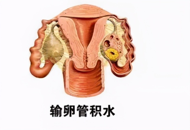 这3类病症或是祸首,这三种病其实都属于癌前病变