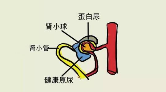 体检出现尿潜血该怎么避免,体检发现尿潜血怎么办