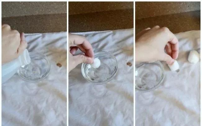 名门泽佳去眼袋红肿结痂图片,名门泽佳去眼袋效果怎么样