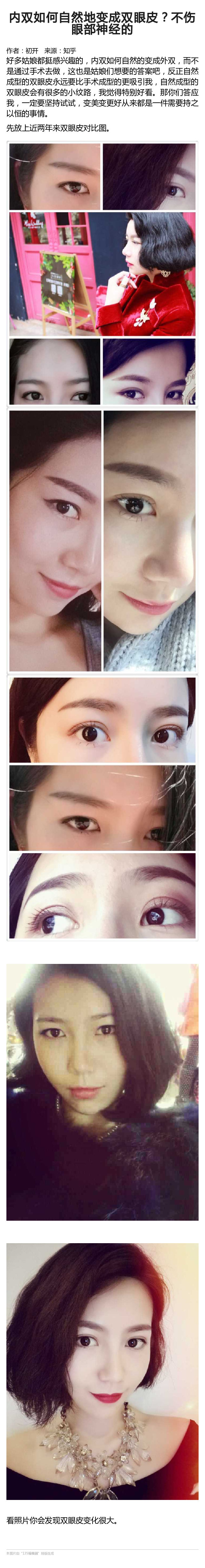 内双怎么才能自然变成双眼皮,内双怎么才能变成双眼皮