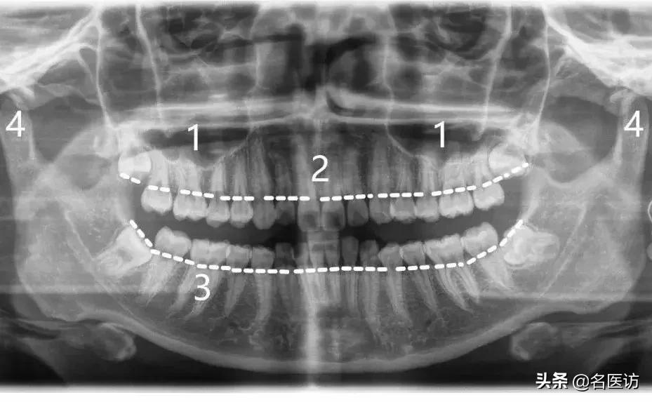 矫正牙科普馆,矫正牙齿科普知识