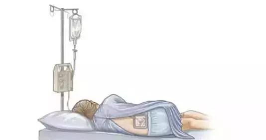 什么是无痛分娩,真的不痛吗?