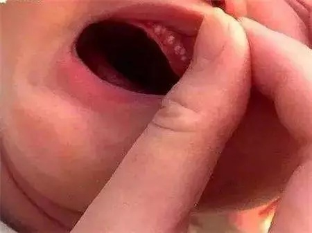 当妈妈才知道什么是现实,宝宝有这变化肯定是要生病了