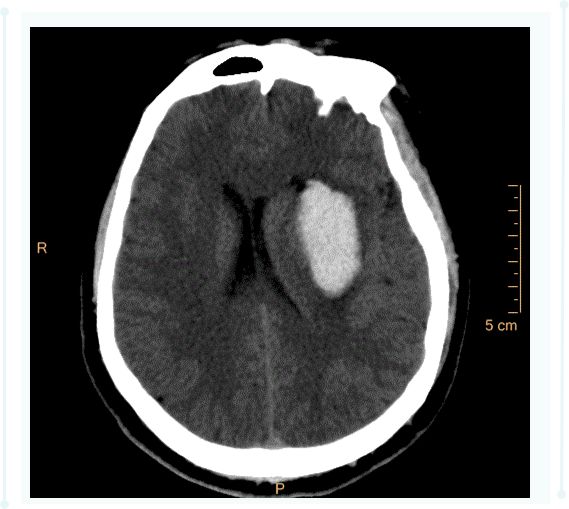 ct后处理重建技术,ct后处理技巧