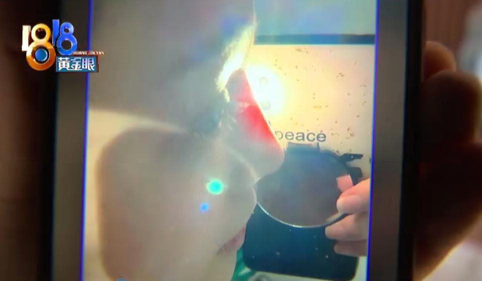 两万多做鼻子,两万做鼻子会不会太贵