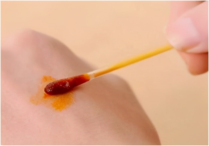 皮肤擦伤该如何预防和处理,皮肤擦伤该怎么办