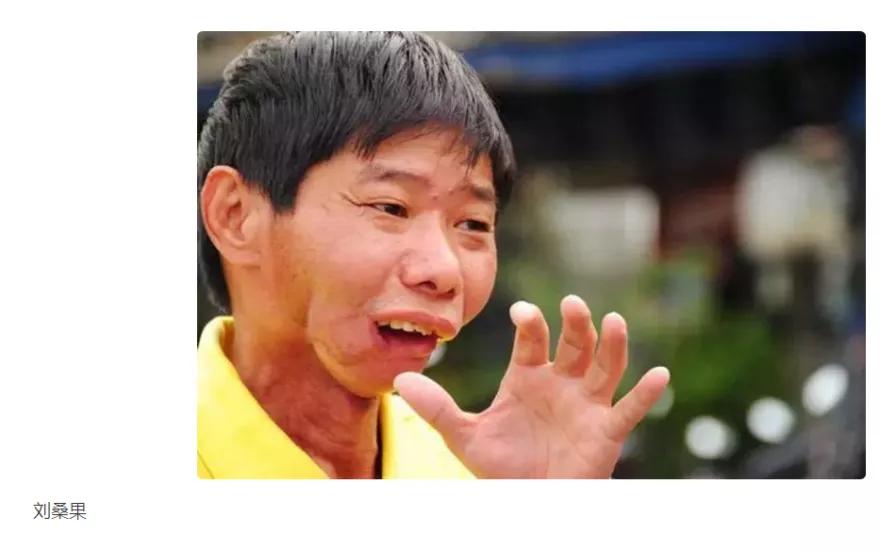 槟榔加烟对身体有哪些危害,槟榔加烟有什么危害吗