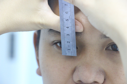 做双眼皮时判断出肌无力但未提肌,做双眼皮说是眼睛肌力不够