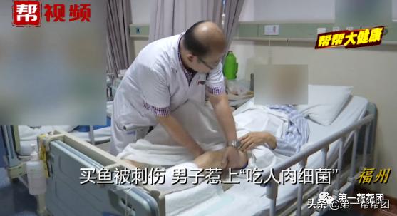 买鱼被鱼刺中截肢,手指被鲈鱼鳍扎伤