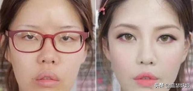 戴眼镜双眼无神怎么恢复,女生长期戴眼镜