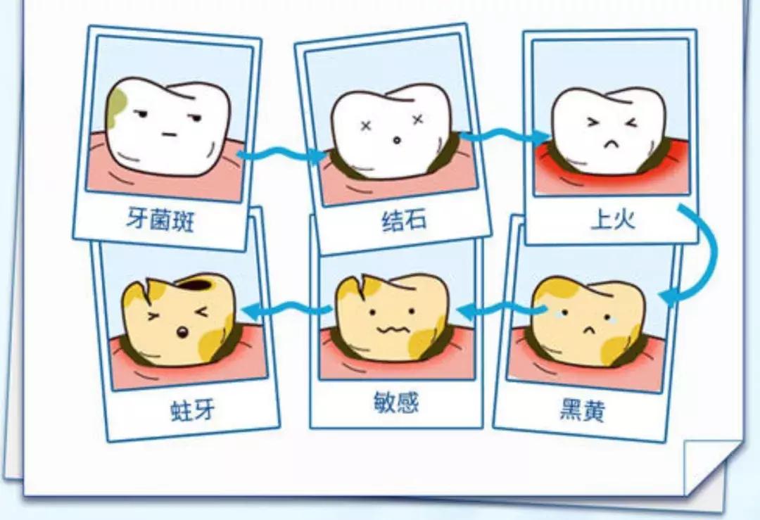 智齿真的痛起来要命,智齿一疼整个下巴都疼