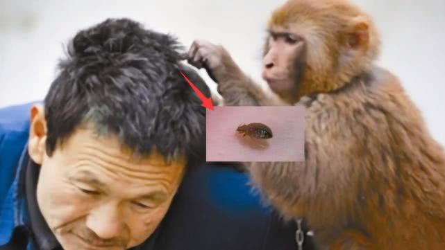 有的人长，有的人不长，为什么虱子总是光顾你？