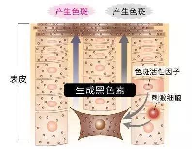 皮肤长斑有民间小方法祛斑吗,教你几招简单祛斑小方法
