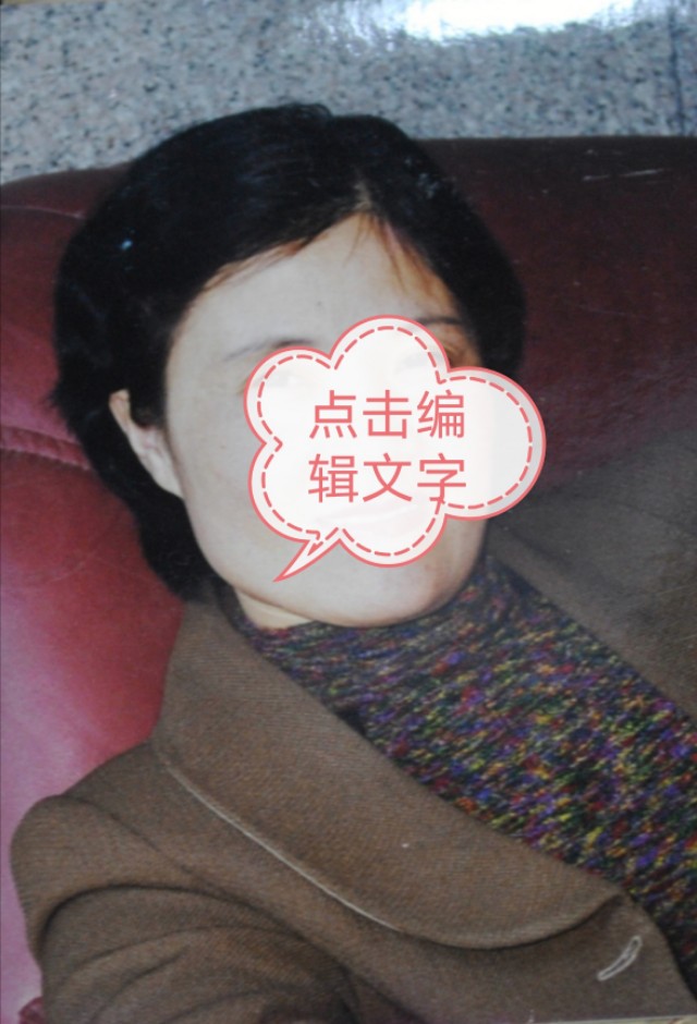 遮盖白发头顶的假发,假发遮盖白发发型