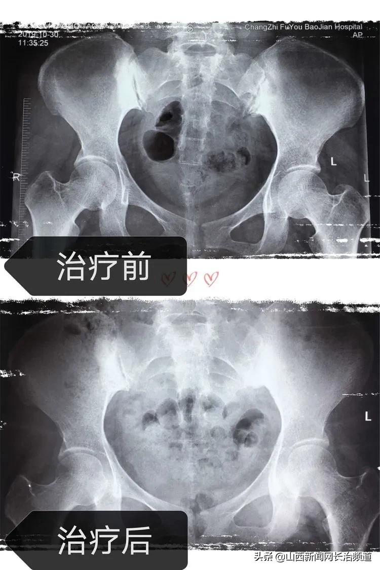 产后42天复查什么？长治市妇幼保健院的专家讲给您听